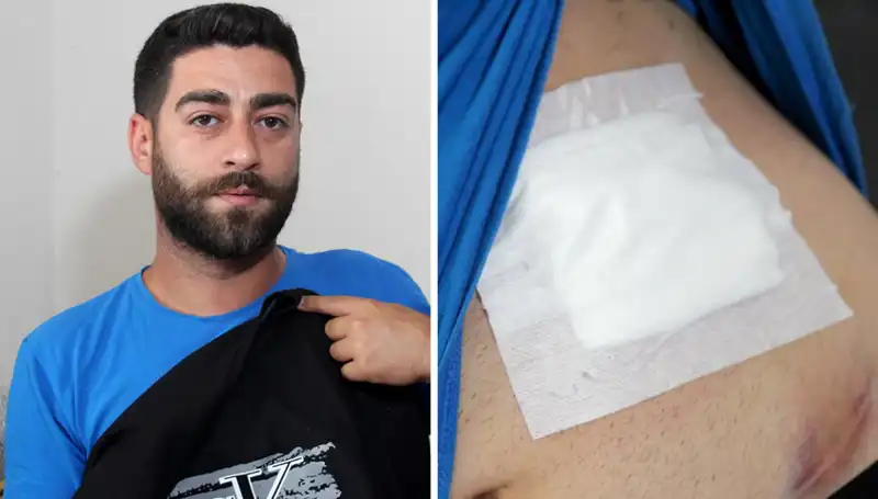Karnındaki Ağrının Sebebi Röntgenle Şaşırtıcı Şekilde Ortaya Çıktı