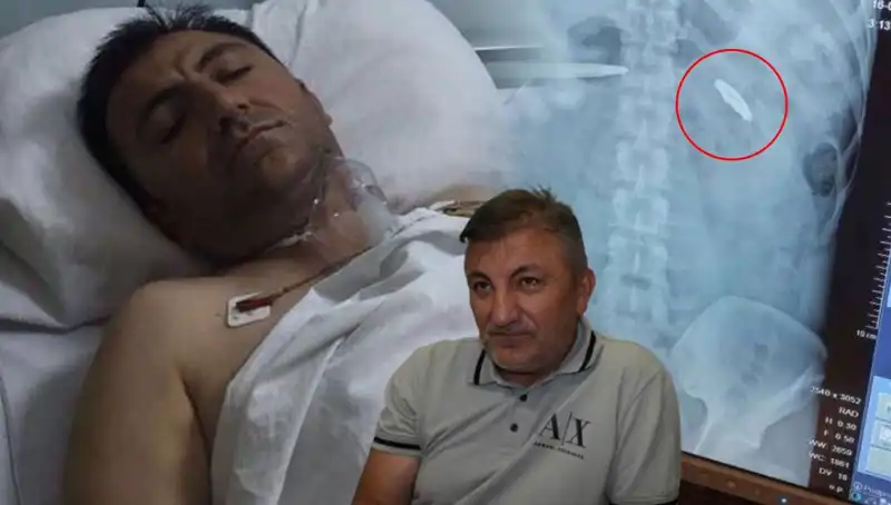 15 Temmuz'un Derin Yaraları: Vücudunda Kurşunla Yaşayan Bir Hayat Hikayesi