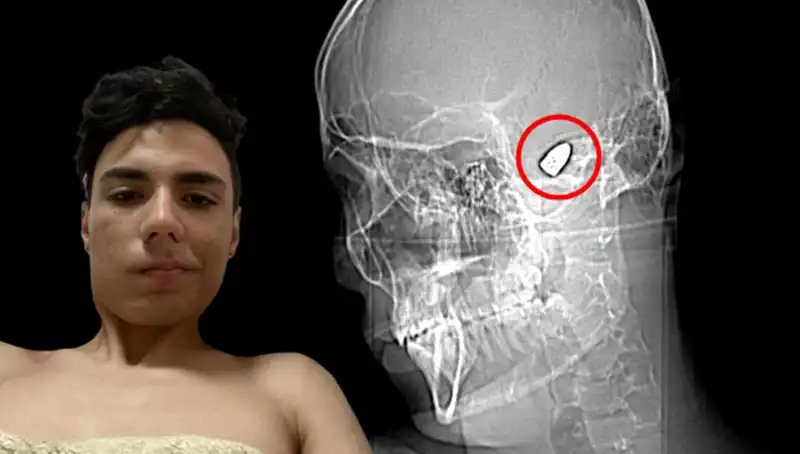 Kafasında Patlayan Düşünceler: Zihin Sağlığı Üzerine Dikkat Çeken Öykü