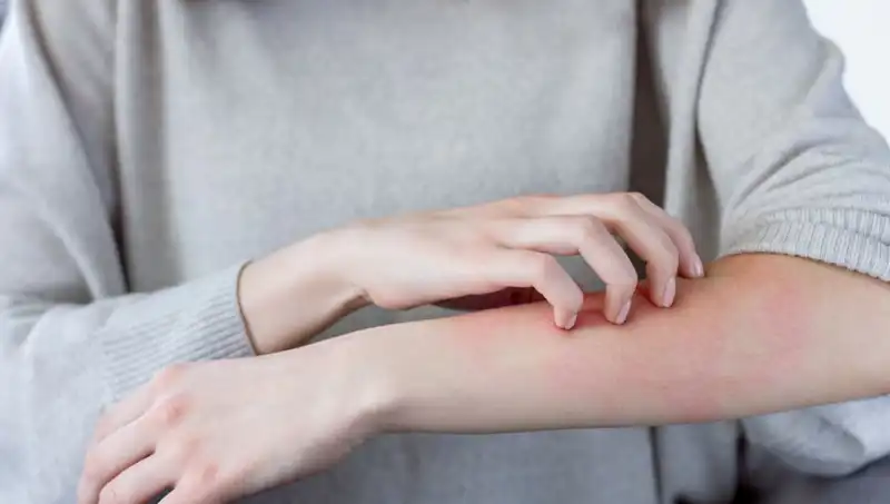Cilt Kanseri Riski: Dermatologdan Beklenmedik İki Belirti Uyarısı!